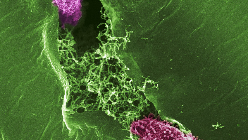Pseudomonas bacteria invading a plant leaf through stomata. (False colored scanning electron microscopic image; copyright Sonja Kersten & Detlef Weigel, MPI for Biology Tübingen)