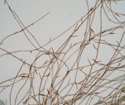 Microscopic view of Ectocarpus sp. mature gametophyte filaments. Gametes are produced in plurilocular gametangia, structures that become thicker and dark-brown when mature.