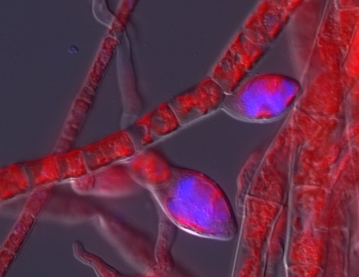 Unter dem Fluoreszenzmikroskop beobachtete Virus-Symptome bei der fadenförmigen Braunalge Ectocarpus sp.